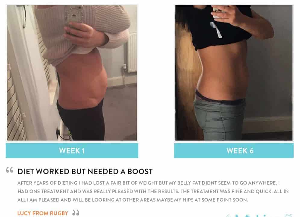 Before and After Dieting Greater London (Redbridge)