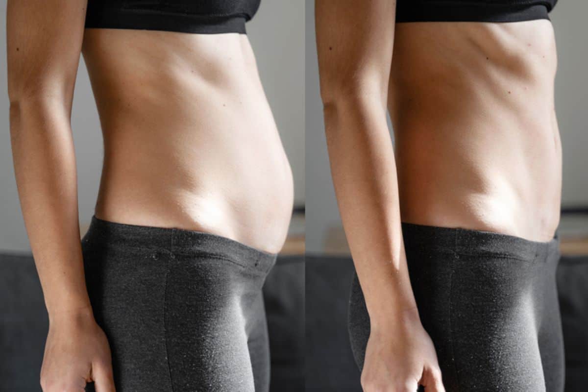 Post-Pregnancy: What Happens to Your Abdominal Muscles After Birth Greater London (Redbridge)
