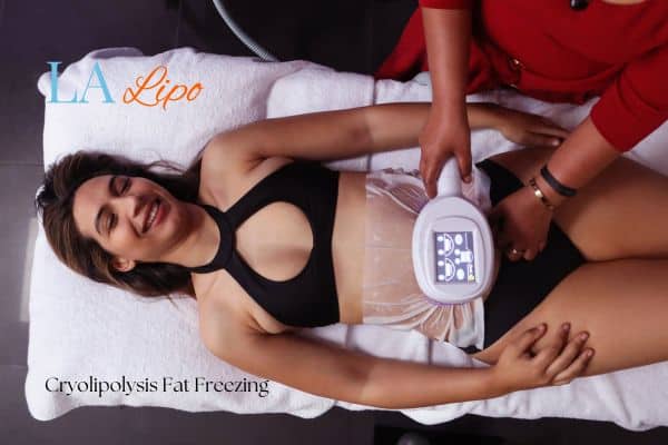 woman getting cryolipolysis Greater London (Redbridge)
