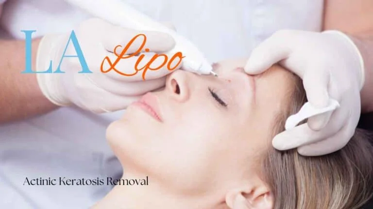 Woman receiving Actinic Keratosis Removal Treatment Greater London (Redbridge)