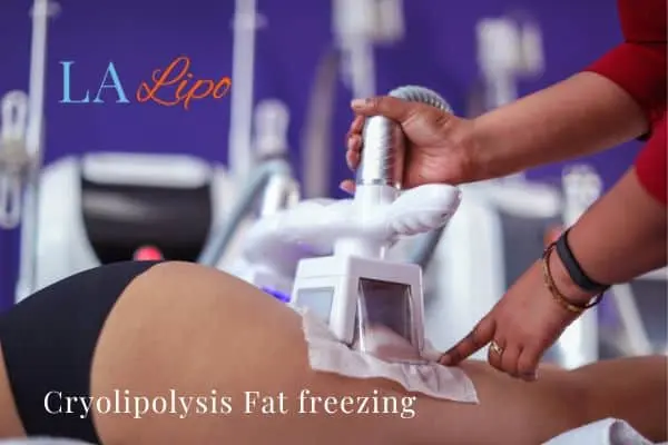 women getting fat freezing Greater London (Redbridge)