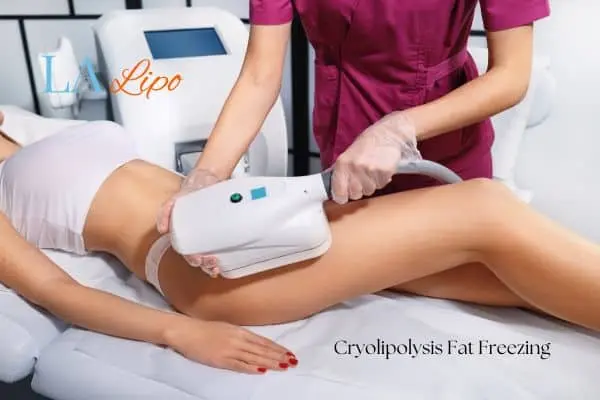 Woman receiving coolsculpting Greater London (Redbridge) treatment on her thighs