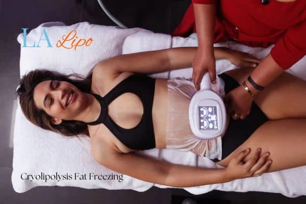 woman getting cryolipolysis Greater London (Redbridge)