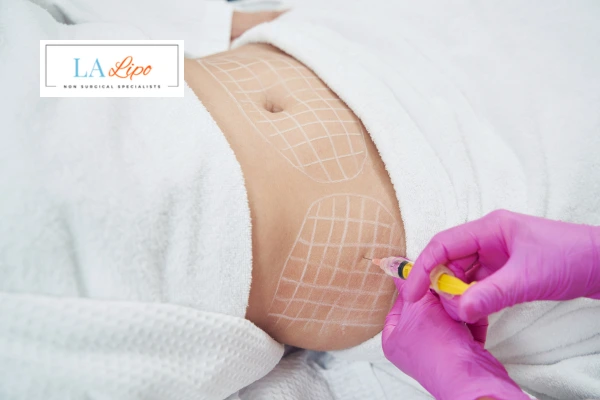 aqualyx fat dissolving injections Greater London (Redbridge)