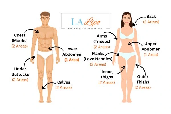 LA LIPO Cryolipolysis Areas Greater London (Redbridge)