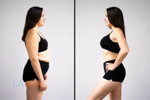 link between body image and mental health Greater London (Redbridge)