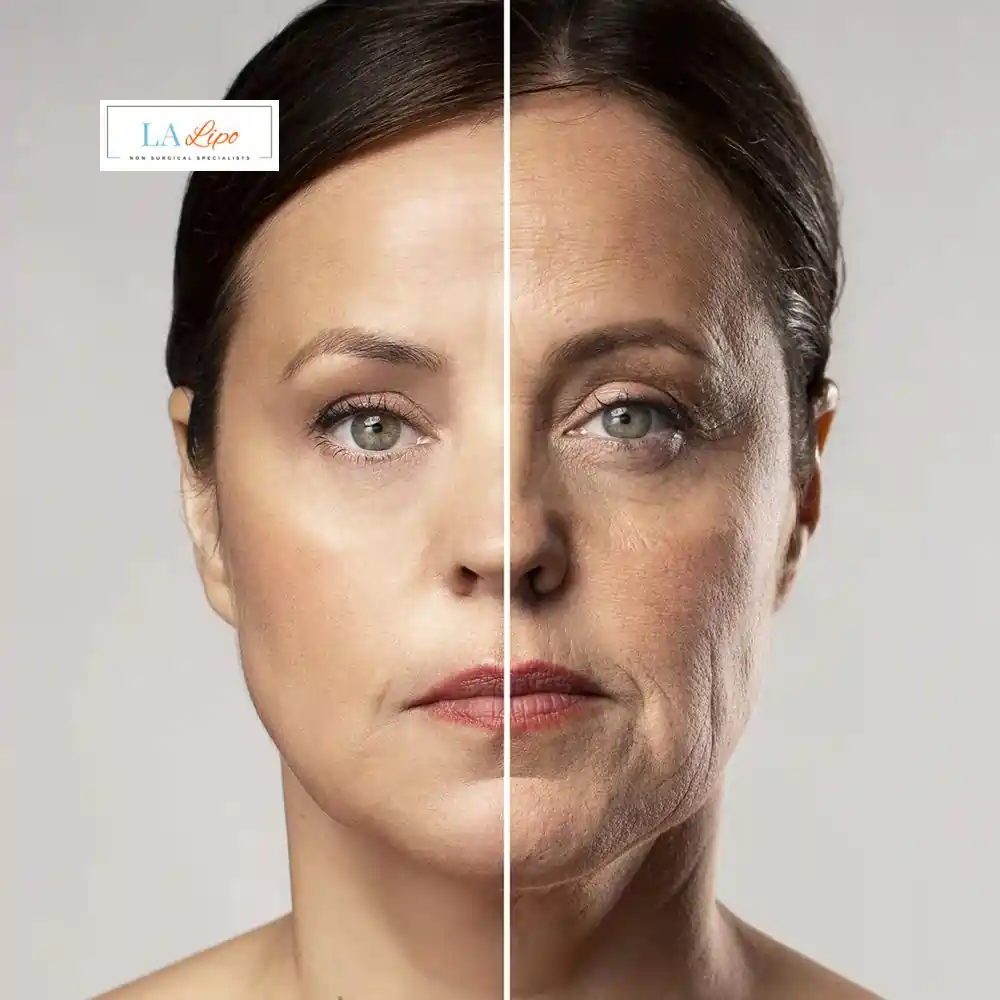 How Can You Tell If Non-Surgical Skin Tightening Is Right for You Greater London (Redbridge)?