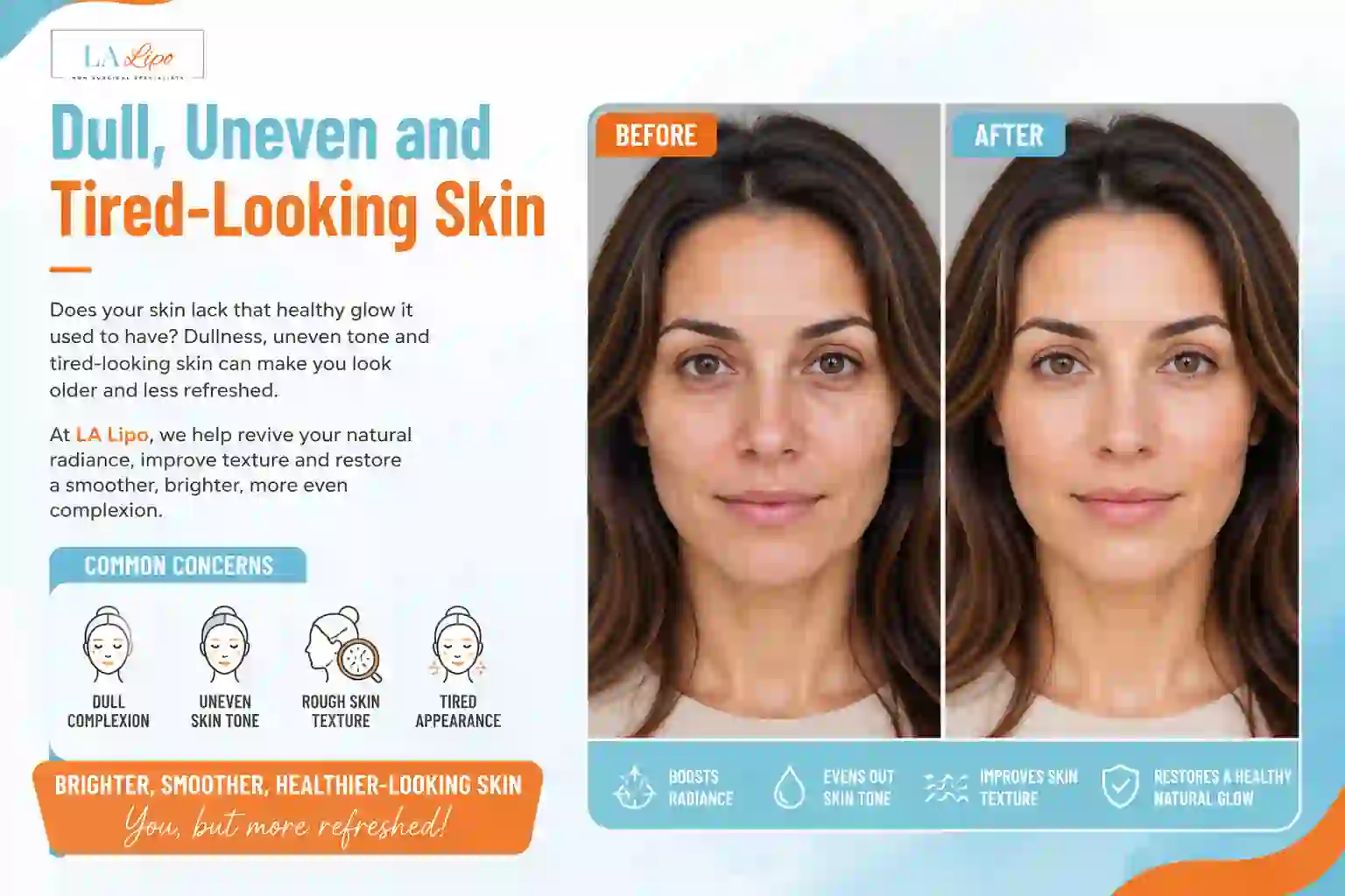 Sign #5: Dull, Uneven and Tired-Looking Skin Greater London (Redbridge)