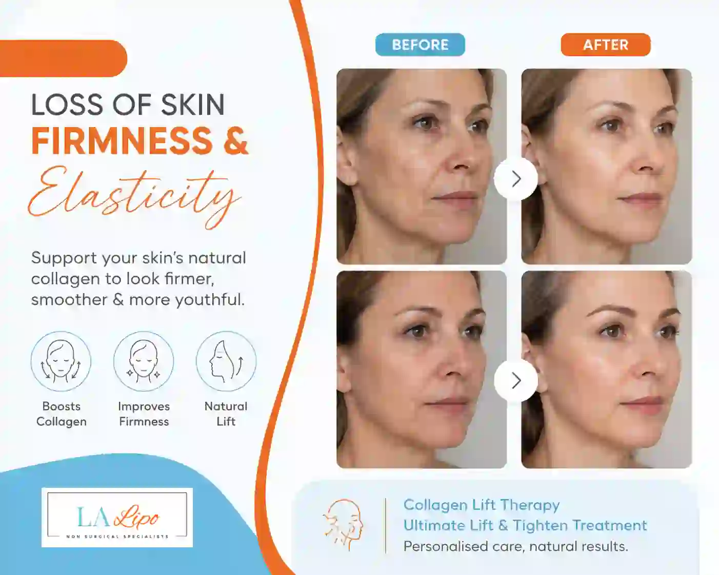 Sign #7: Loss of Skin Firmness and Elasticity Greater London (Redbridge)